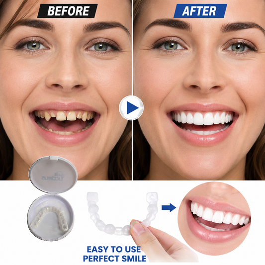 Snap in Teeth | طقم أسنان تجميلي Snap-In
