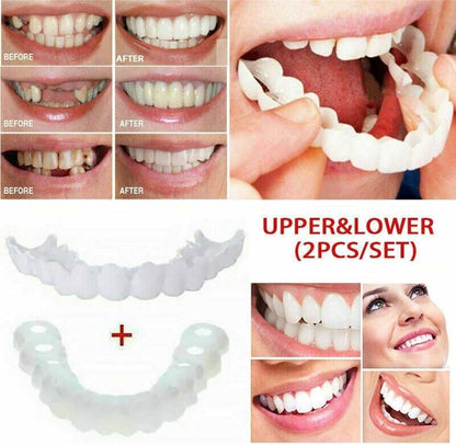Snap in Teeth | طقم أسنان تجميلي Snap-In
